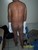 Bugoy Full Body Eczema Dermatitis - 21 Jan 07